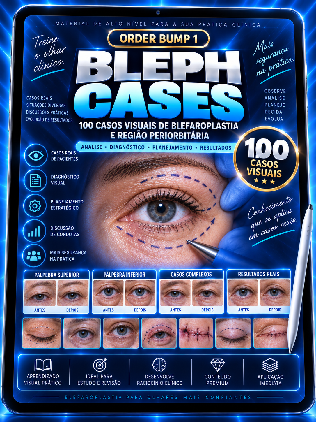 CHECKLIST BLEPH