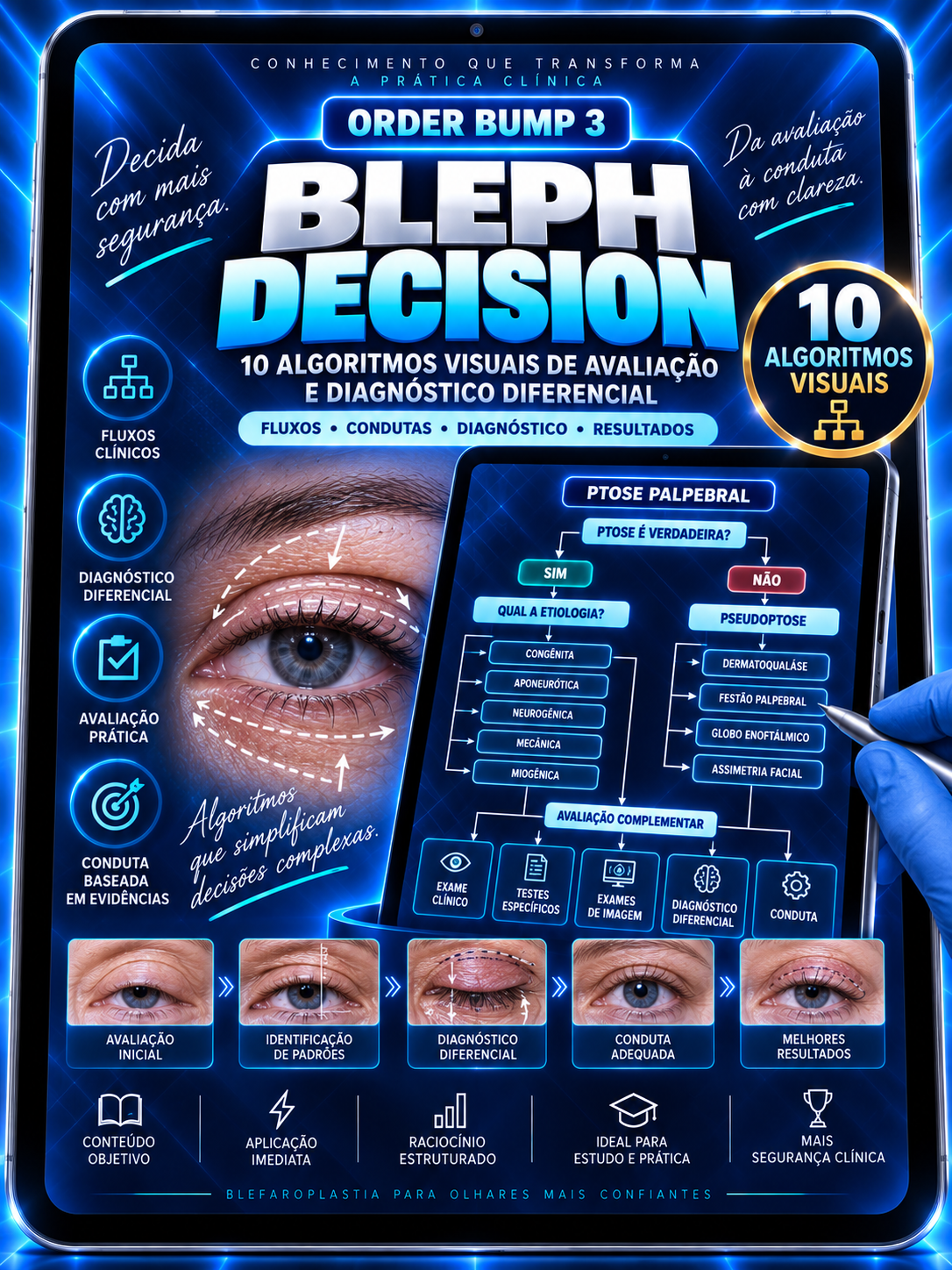 BLEPH ANATOMY CARDS
