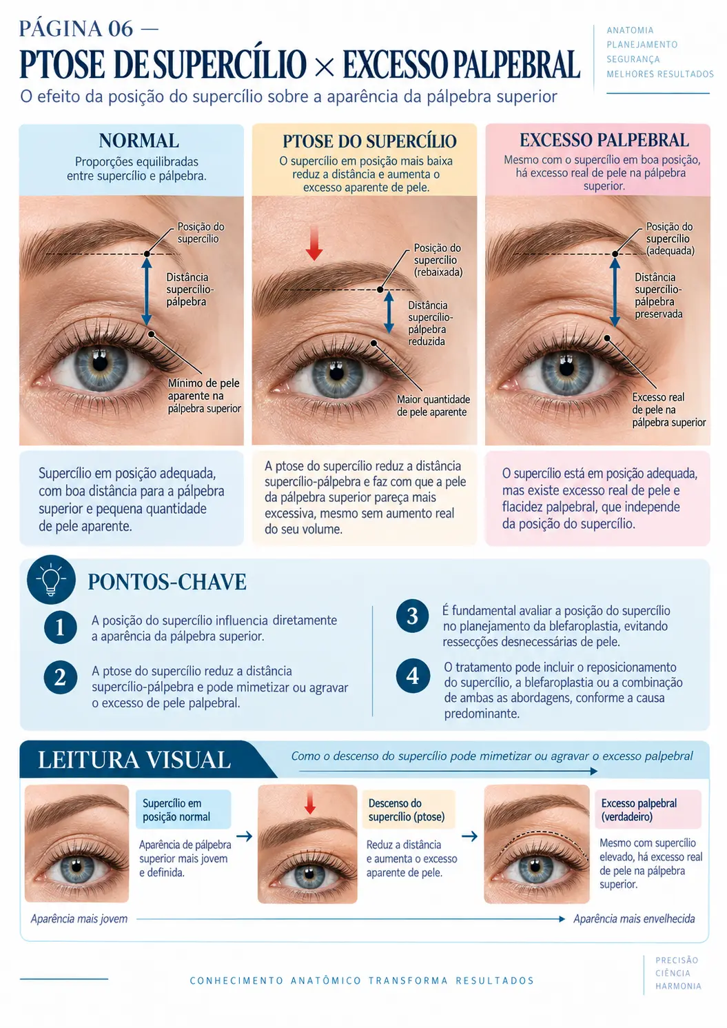 Página do BLEPH MAP: Ptose de Supercílio × Excesso Palpebral